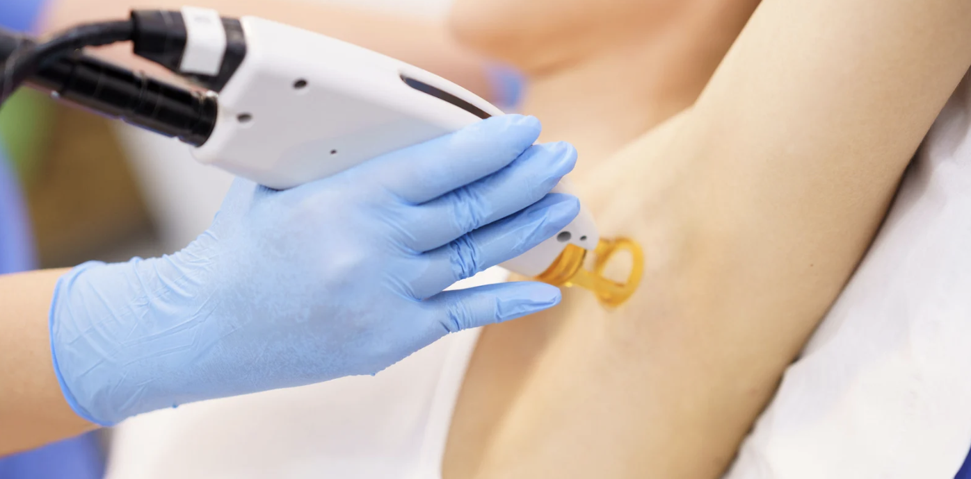 Laser Hair Removal in Frederick MD